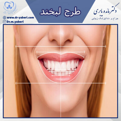 طرح لبخند - دکتر یابری