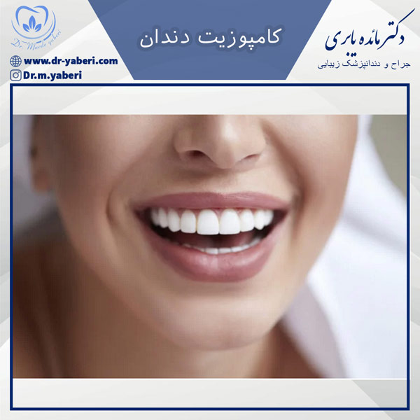 عکس کامپوزیت دندان