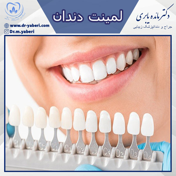 لمینت دندان - دکتر یابری