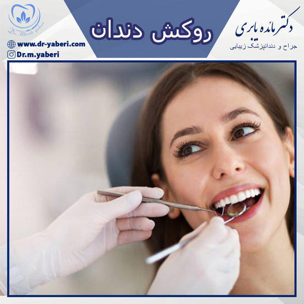 روکش دندان - دکتر یابری