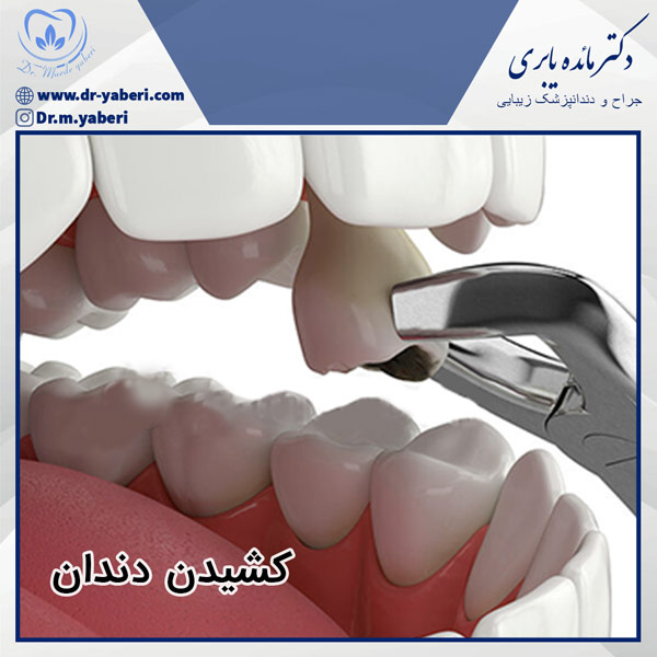 عکس کشیدن دندان
