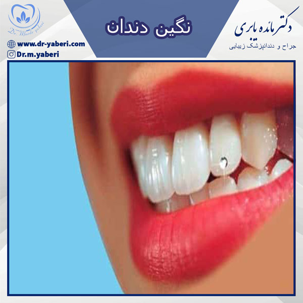 نگین دندان - دکتر یابری