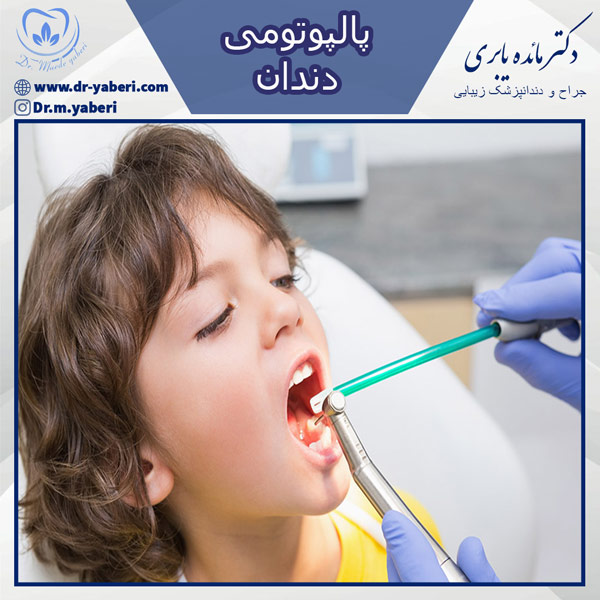پالپوتومی - دکتر یابری