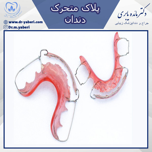 پلاک متحرک - دکتر یابری
