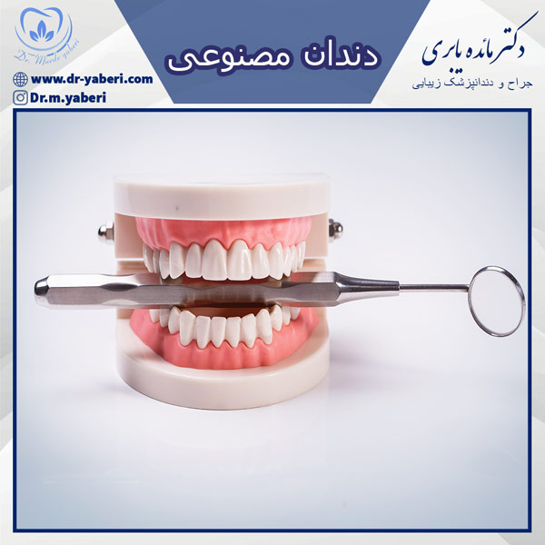 دندان مصنوعی - دکتر یابری