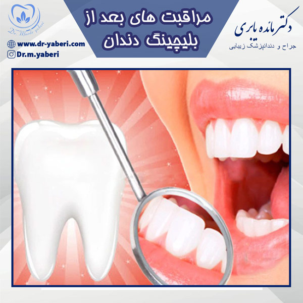 مراقبت های بعد از بلیچینگ دندان - دکتر مائده یابری