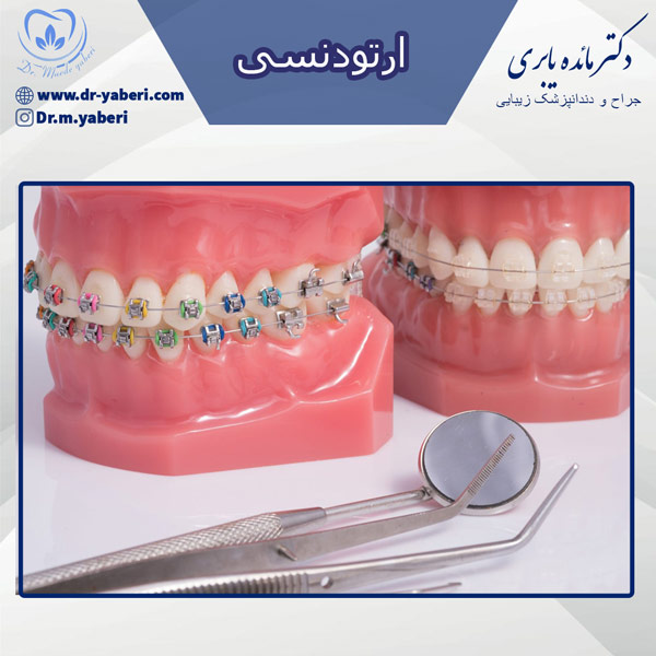 ارتودنسی - دکتر مائده یابری