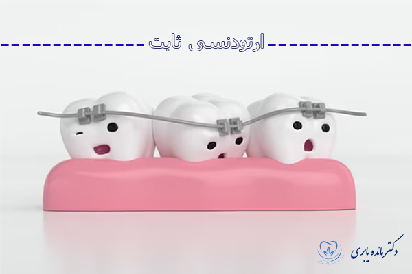 عکس ارتودنسی ثابت