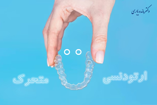 ارتودنسی متحرک - دکتر مائده یابری