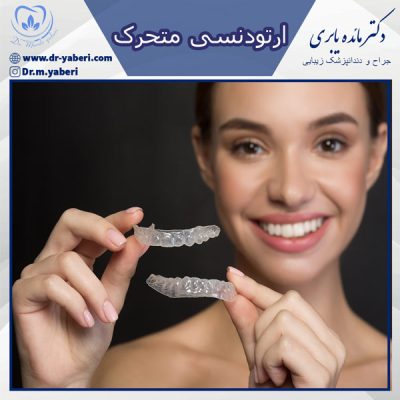 ارتودنسی متحرک - دکتر مائده یابری در تهران