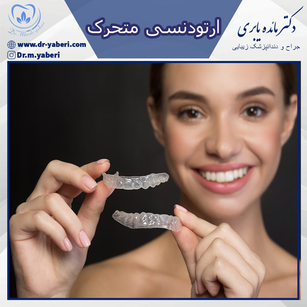 ارتودنسی متحرک - دکتر مائده یابری در تهران