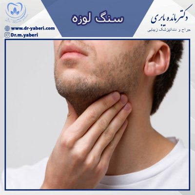 سنگ لوزه - دکتر مائده یابری در تهران