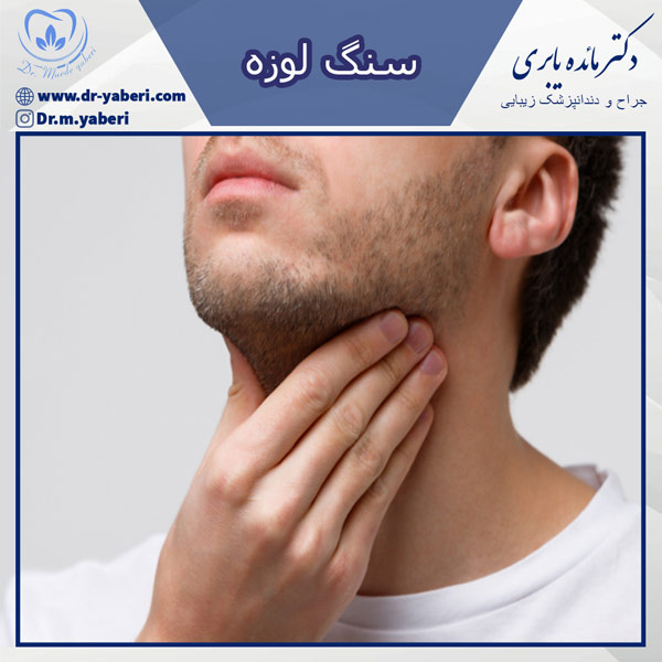 سنگ لوزه - دکتر مائده یابری در تهران