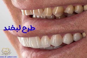 طرح لبخند - دکتر مائده یابری