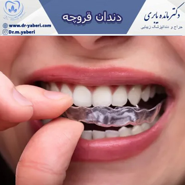 دندان قروچه