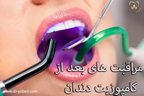 مراقبت های بعد از کامپوزیت دندان - دکتر مائده یابری