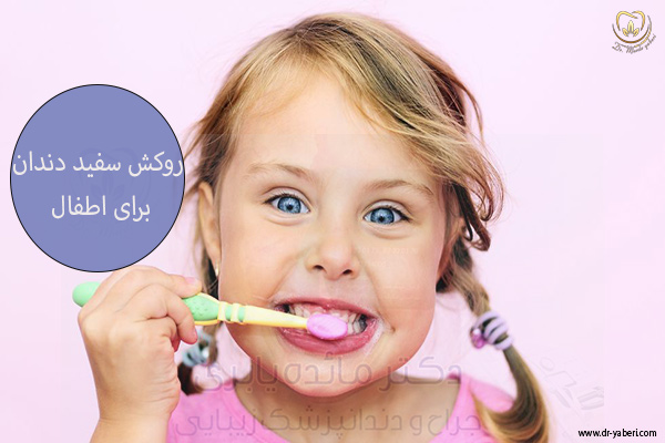 عکس روکش سفید دندان برای اطفال - دکتر مائده یابری