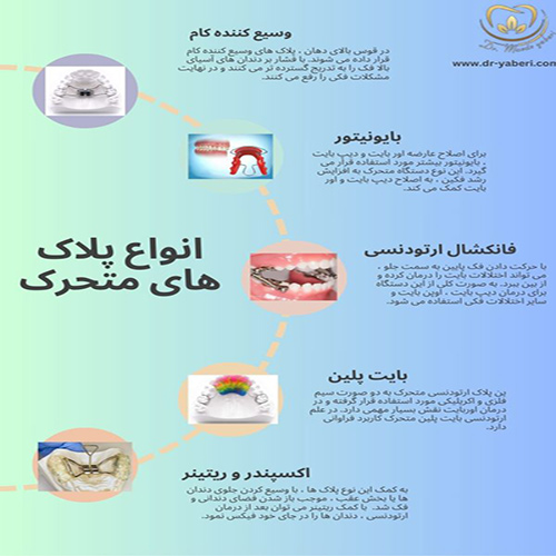 پلاک متحرک - دکتر مائده یابری