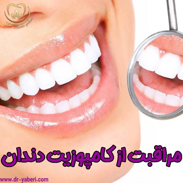 عکس مراقبت از کامپوزیت دندان