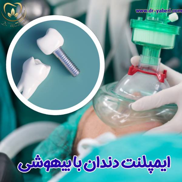 عکس ایمپلنت دندان با عمل بیهوشی - دکتر مائده یابری