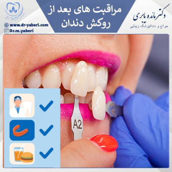مراقبت های بعد از روکش دندان - دکتر مائده یابری