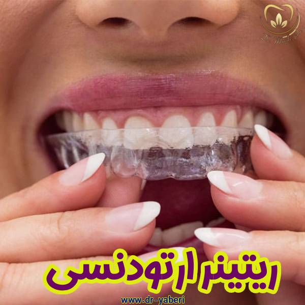 ریتینر ارتودنسی - دکتر مائده یابری