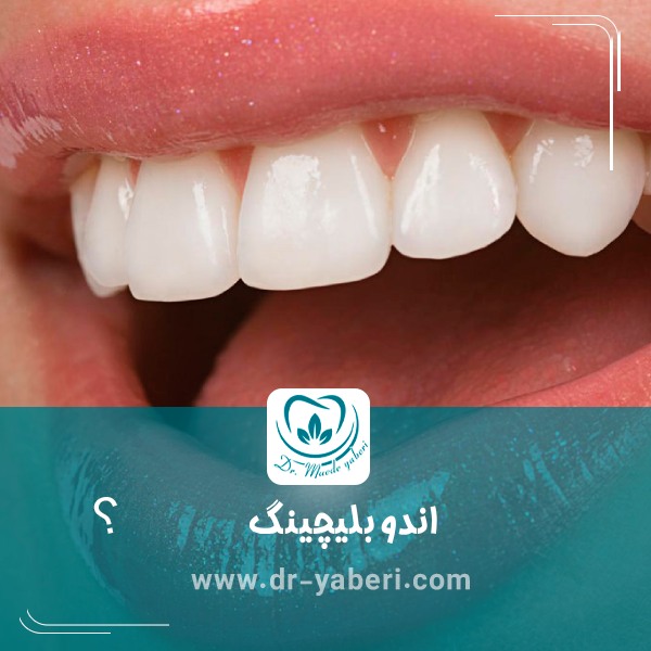 اندوبلیچینگ