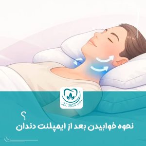 نحوه خوابیدن بعد از ایمپلنت دندان