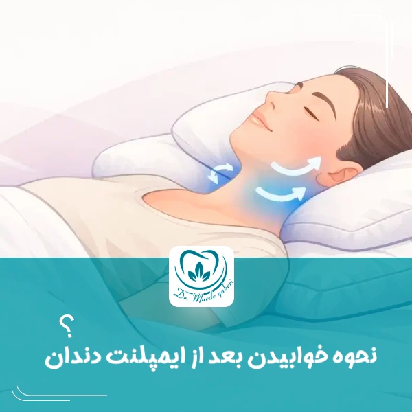 نحوه خوابیدن بعد از ایمپلنت دندان