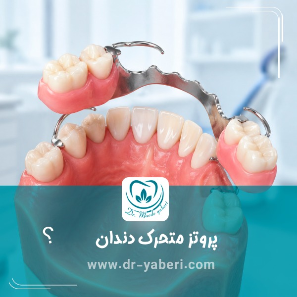 پروتز متحرک دندان