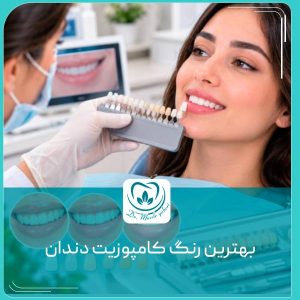 رنگ کامپوزیت دندان