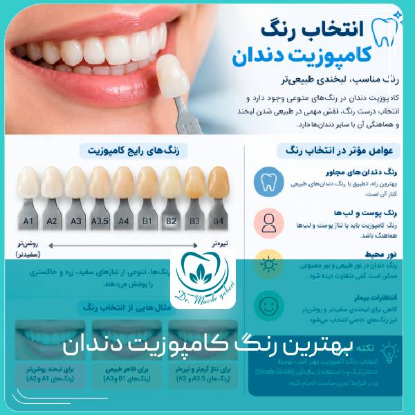 انتخاب رنگ کامپوزیت دندان