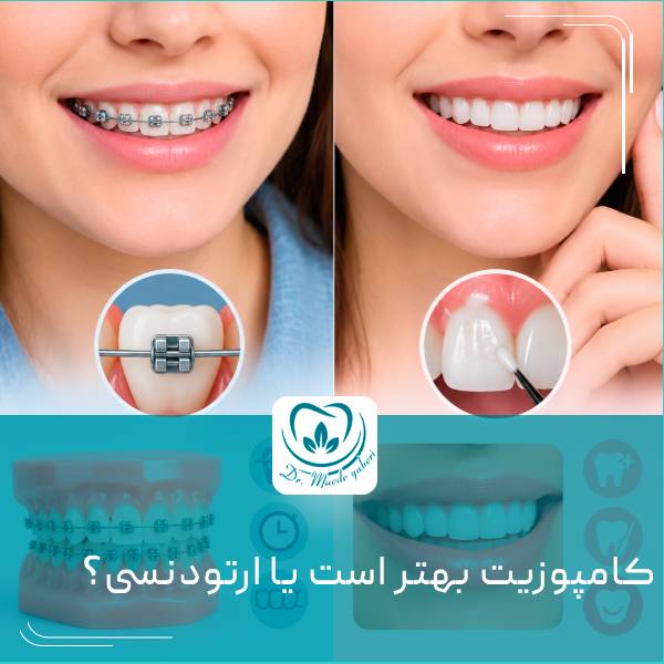 ارتودنسی بهتر است یا کامپوزیت دندان؟